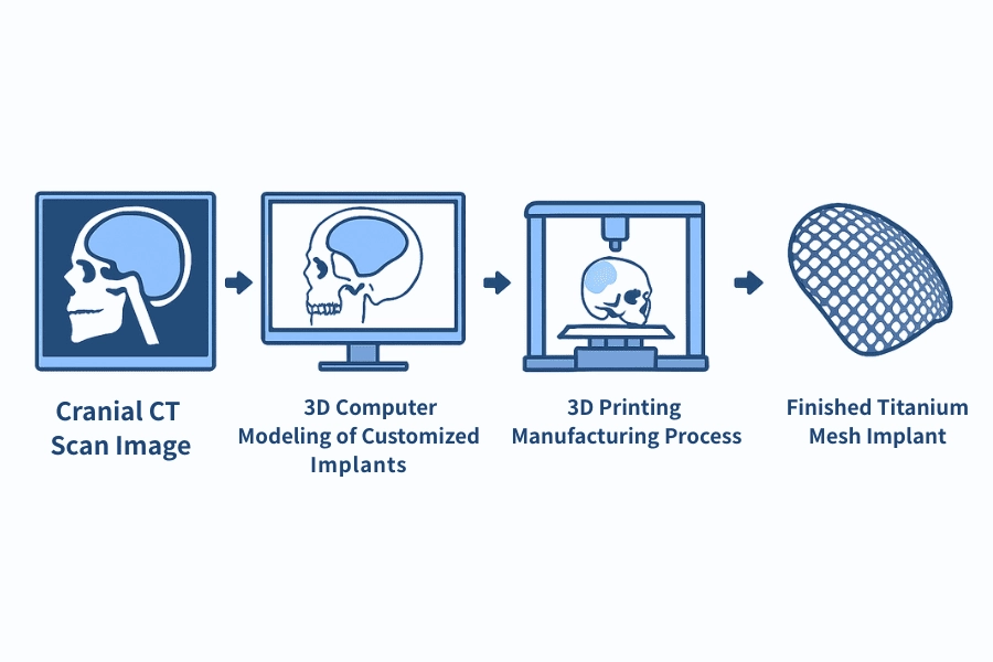 3D Modeling for Cranial Bone Reconstruction Design