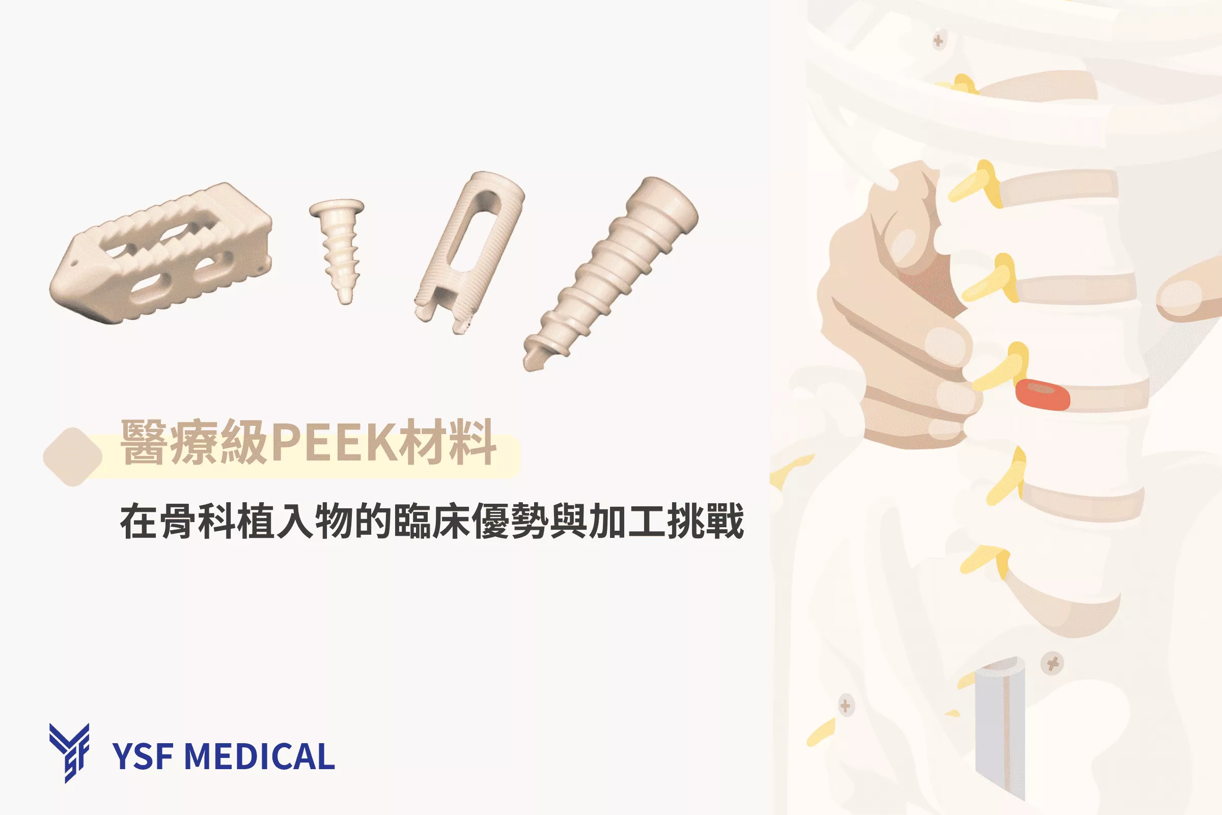 如何選擇合適的骨科植入物製造商