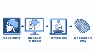 3D建模頭部骨骼重建設計